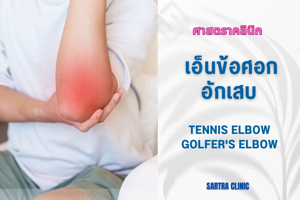 เคยไหม? ปวดบริเวณข้อศอก เจ็บที่ข้อศอก ด้านนอก ด้านใน