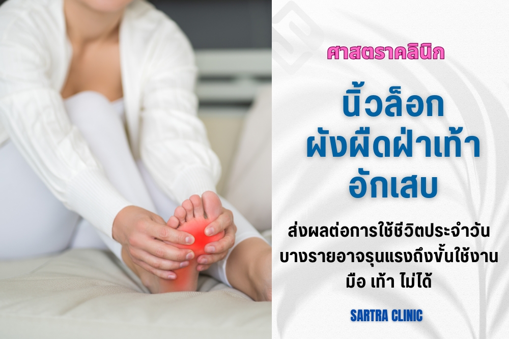 นิ้วล็อก ผังผืดฝ่าเท้าอักเสบ
