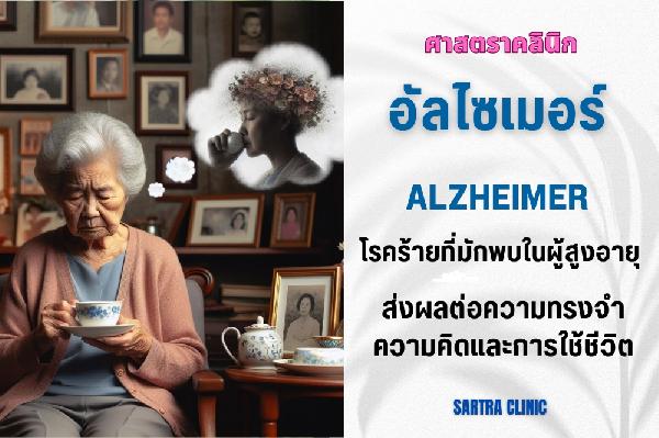 อัลไซเมอร์ โรคร้ายที่มักพบในผู้สูงอายุ