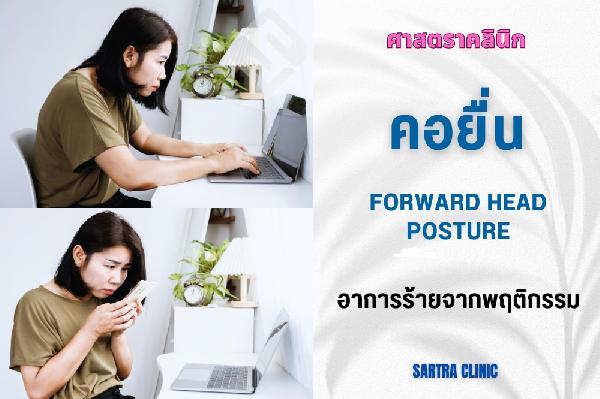 คอยื่น อาการร้ายจากพฤติกรรม