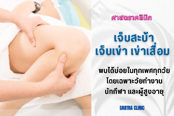 เจ็บสะบ้า เจ็บเข่า เข่าเสื่อม เจ็บเข่าด้านนอก