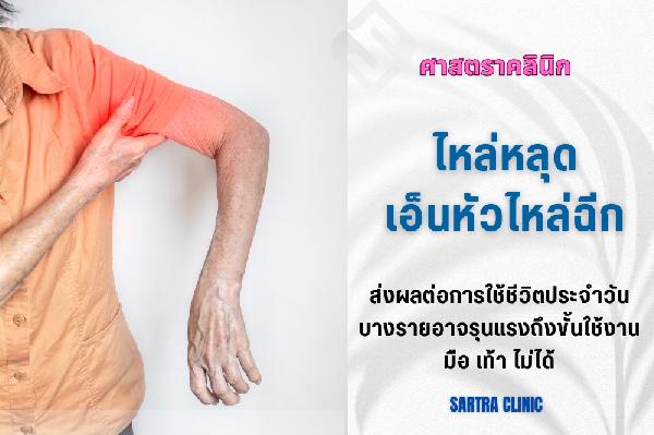 ไหล่หลุด เอ็นหัวไหล่ฉีก ผ่าตัดดีจริงหรือ?